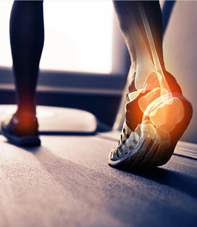 Fife Therapy Provides Physical Therapy for Gait Analysis in Savannah Ga